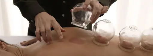Cupping Therapie
